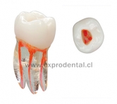 Diente Acril Endo Entrenamiento Vdw