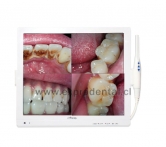 Camara Intrao Lcd Multimedia